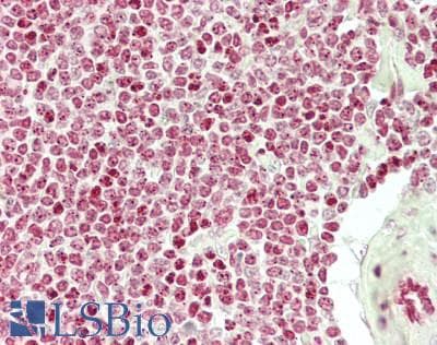 IHC-plus™ PSIP1 / LEDGF Antibody (aa480-C-term)