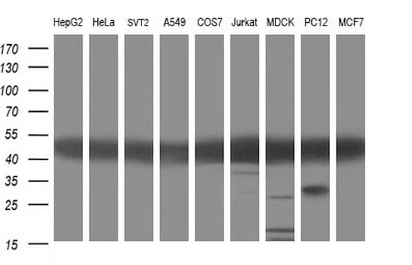 TUBA1A / Tubulin Alpha 1a Antibody (clone OTI2C8)