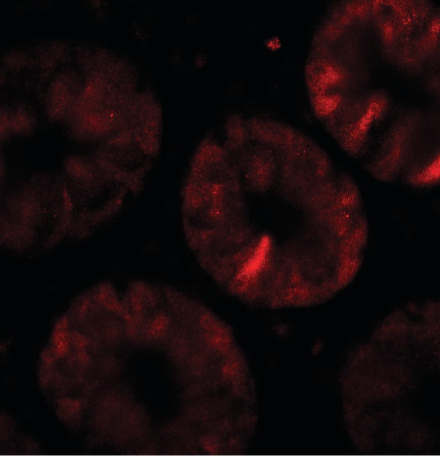 IHC-plus™ TOX Antibody