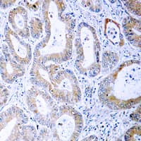 MEK1 + MEK2 Antibody (phospho-Ser222/Ser226)