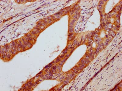 DUSP13 Antibody