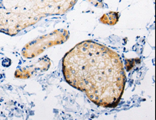 Polyclonal Rabbit anti-Human RAB6A / RAB6 Antibody (IHC, WB)