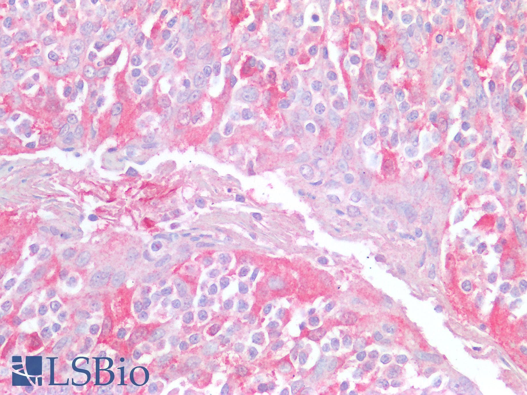 PathPlus™ CCR5 Antibody