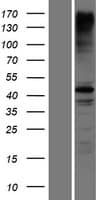 RNF135 Protein (Over-Expression Lysate Myc-DDK (Flag))