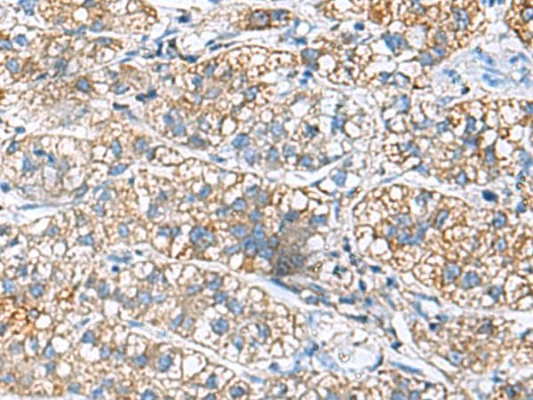JOSD1 Antibody