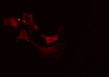 Polyclonal Rabbit anti-Human SLC9A6 Antibody (IF, WB)