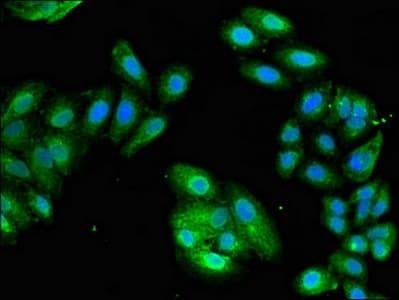EIF3M / PCID1 Antibody