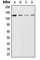 Polyclonal Rabbit anti-Human GCFC2 Antibody (Internal, WB)