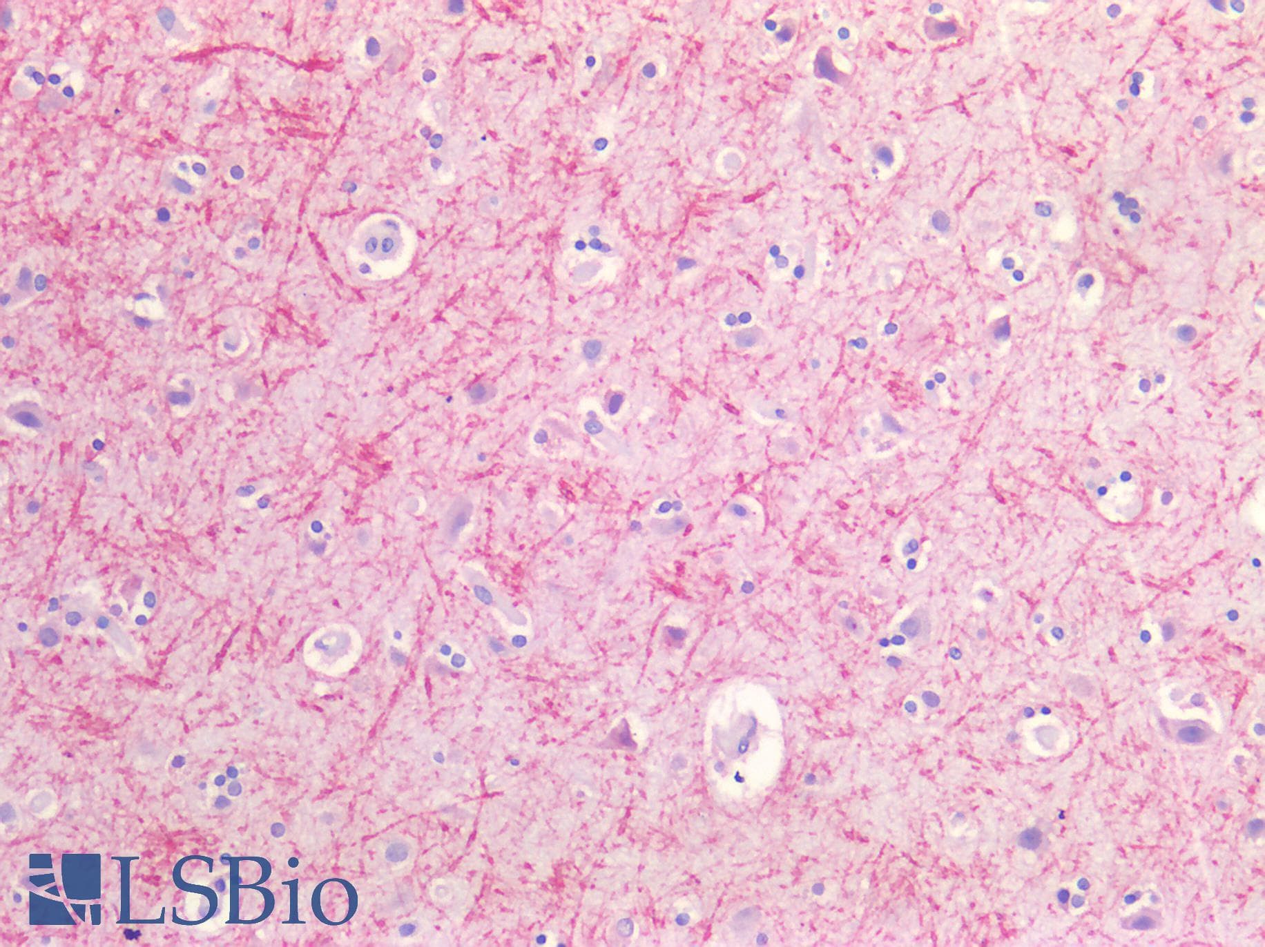 PathPlus™ GLUL / Glutamine Synthetase Antibody