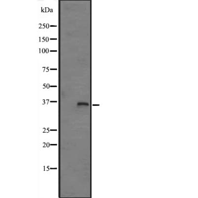 FN3K / Fructosamine-3-Kinase Antibody