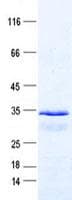 Human MtTFA / TFAM Protein (Recombinant His, N-Terminal)