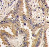 Polyclonal Rabbit anti-Human BAD Antibody (aa53-81, IHC, WB)