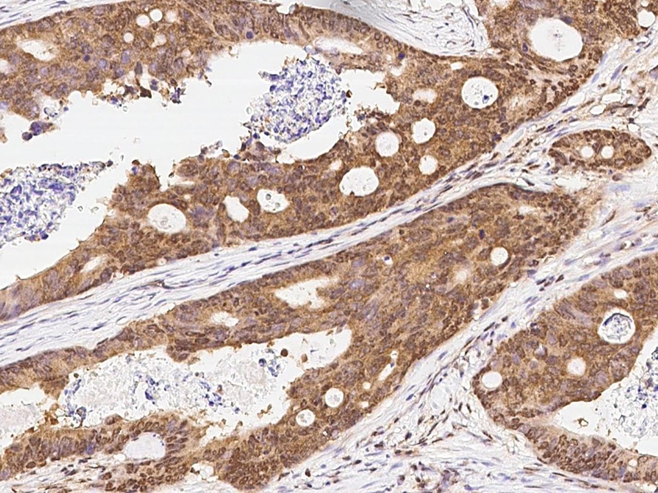 CDK6 Antibody (Preservative Free)
