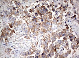 Monoclonal Mouse anti-Human PIK3CA / PI3K Alpha Antibody (clone OTI8D6, aa303-631, IHC)