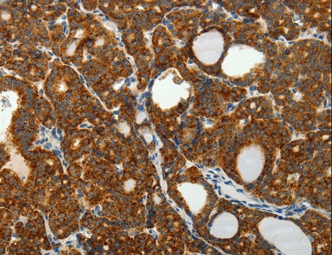 Polyclonal Rabbit anti-Human SELM / Selenoprotein M Antibody (IHC)