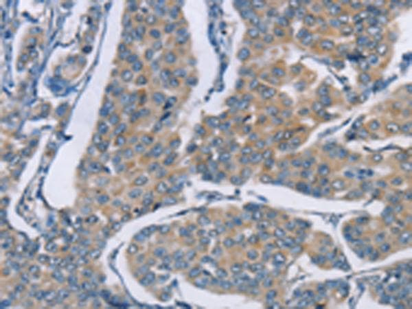 Polyclonal Rabbit anti-Human ZBTB1 Antibody (IHC)