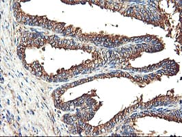 TUBAL3 Antibody (aa150-446, clone OTI2F6, Carrier-free)