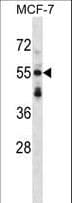 SNTB2 Antibody (aa217-245)