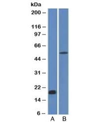 CDH1 / E Cadherin Antibody (clone CDH1/1525)