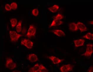 Acetyl-CoA Carboxylase / ACC Antibody (phospho-Ser80)