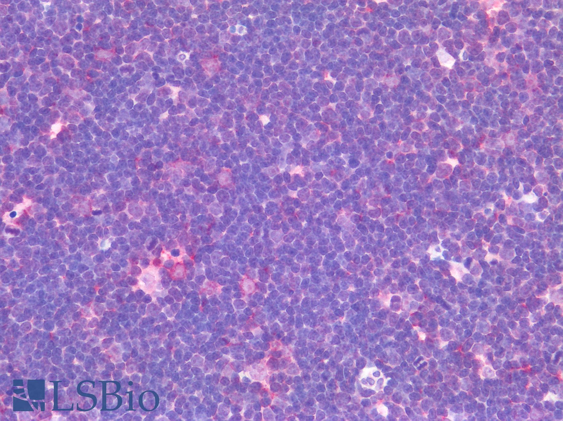 PathPlus™ Polyclonal Rabbit anti-Human DEC-205 / CD205 / LY75 Antibody (C-Terminus, IHC)