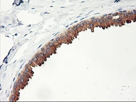 PHF21B Antibody (clone OTI3D1)