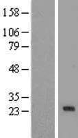 PEMT Protein (Over-Expression Lysate Myc-DDK (Flag))