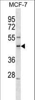 SCML1 Antibody (aa15-41)