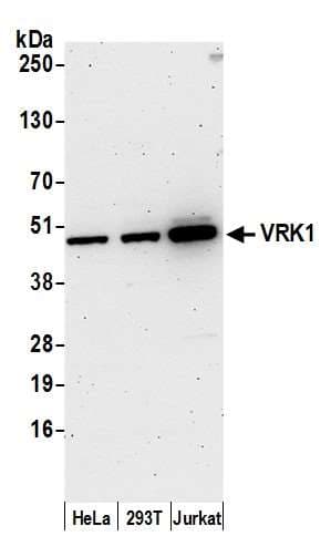 Polyclonal Rabbit anti-Human VRK1 Antibody (aa346-396, WB)