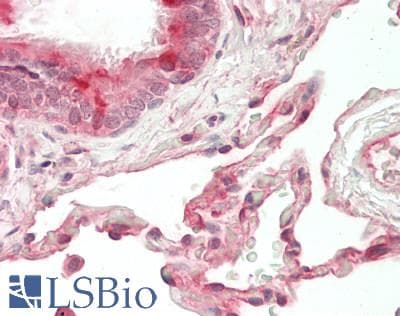 CRADD / RAIDD Antibody (FITC)