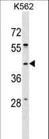 Polyclonal Rabbit anti-Human SPO11 Antibody (aa299-326, WB)