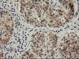 SNAP25 Antibody (clone OTI4G5)