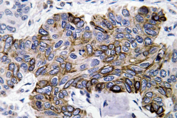 Polyclonal Rabbit anti-Human CCL5 / RANTES Antibody (aa35-84, IHC)