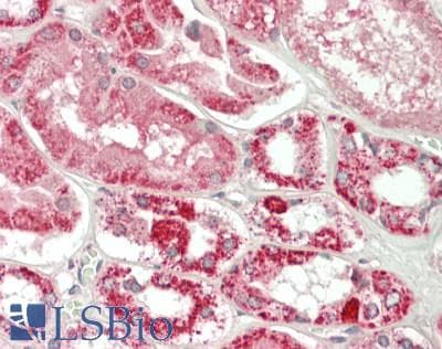 IHC-plus™ ELOVL1 Antibody (Internal)