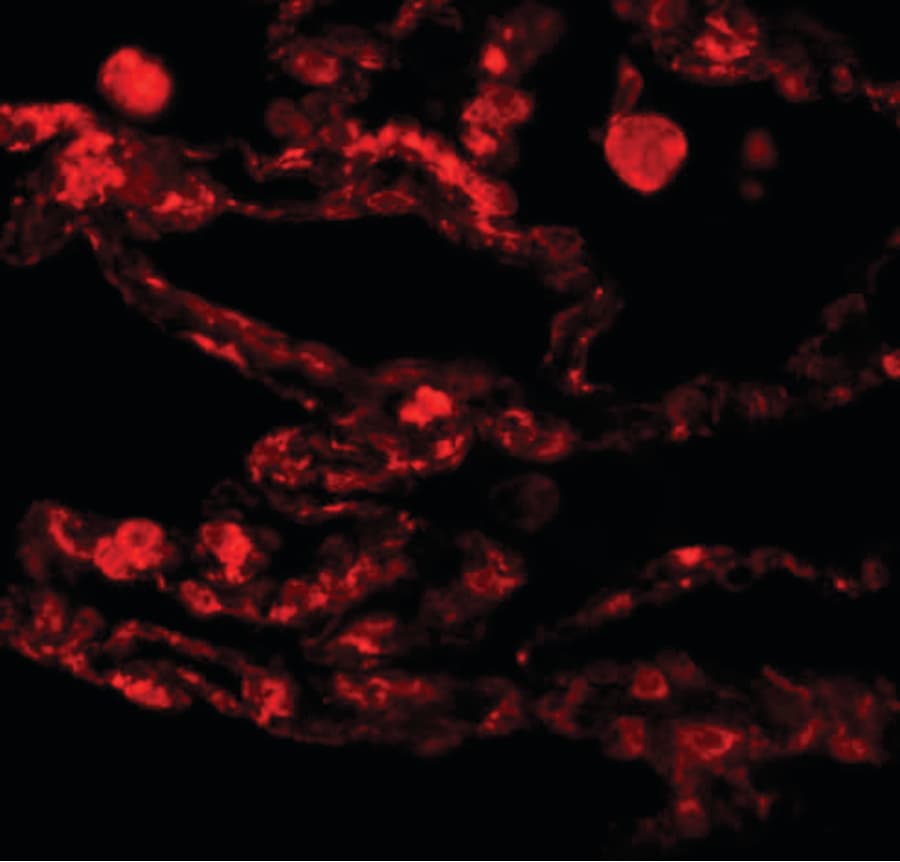 CCDC69 Antibody