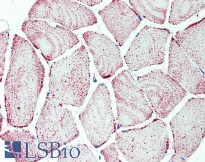 IHC-plus™ NDUFA4 Antibody (10-90 aa, C-terminal)