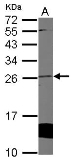 Polyclonal Rabbit anti-Human CYGB / Cytoglobin Antibody (IF, WB)