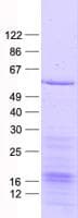 Human MAPKAPK5 / PRAK Protein (Recombinant His, N-Terminal)