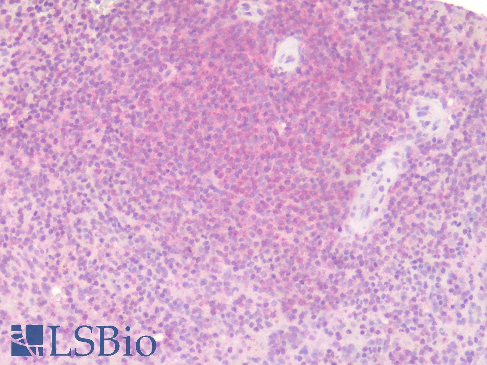 IHC-plus™ WNT5B Antibody (Internal)