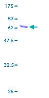 Human ANXA4 / Annexin IV Protein (Recombinant GST)
