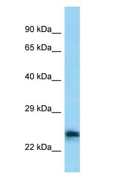 Polyclonal Rabbit anti-Human Calneuron-1 / CALN1 Antibody (aa190-239, WB)
