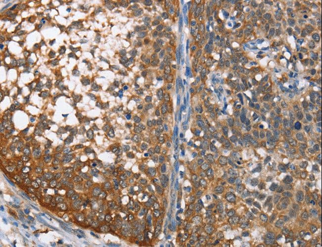 CMT2 / MAD2L1BP Antibody