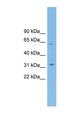 Polyclonal Rabbit anti-Human SLC39A9 Antibody (aa107-156, WB)
