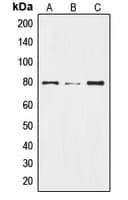 Polyclonal Rabbit anti-Human NOTCH2 Antibody (Internal, WB)