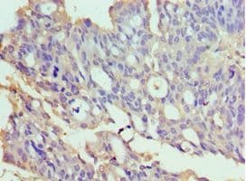 Polyclonal Rabbit anti-Human TXNRD2 Antibody (aa100-310, IHC, WB)
