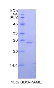 Mouse SPTAN1 / Alpha Fodrin Protein (Recombinant His)