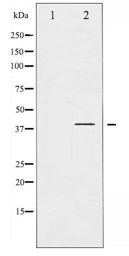 NFKBIA / IKB Alpha / IKBA Antibody (phospho-Tyr305)