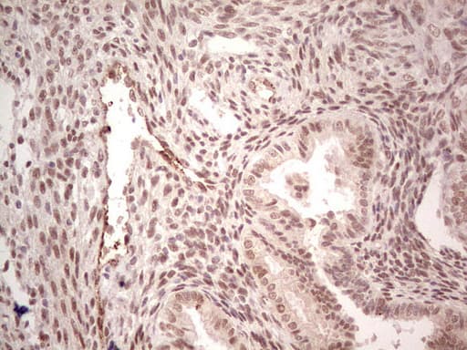NR5A1 / SF1 Antibody (aa1-262, clone OTI1B4)