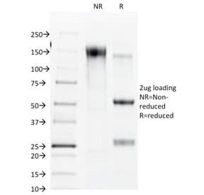 GJB1 / CX32 / Connexin 32 Antibody (clone R5.21C)