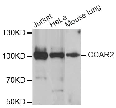CCAR2 / KIAA1967 Antibody